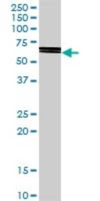 Western Blot: PI4KAP2 Antibody [H00375133-D01P]