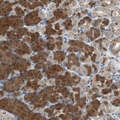 Immunohistochemistry-Paraffin: PI4KB/PI4KIII beta Antibody [NBP1-80906]