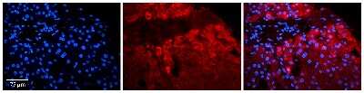 Immunohistochemistry-Paraffin: PI4KB/PI4KIII beta Antibody [NBP3-09346]