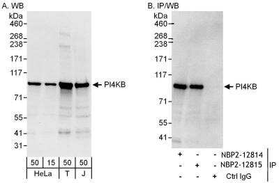 Immunoprecipitation: PI4KB/PI4KIII beta Antibody [NBP2-12814]