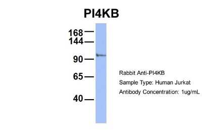 Western Blot: PI4KB/PI4KIII beta Antibody [NBP1-56440]