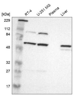 Western Blot: PI4KB/PI4KIII beta Antibody [NBP1-80907]