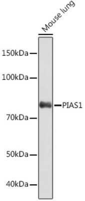 Western Blot: PIAS1 Antibody (3J2O8) [NBP3-16477]