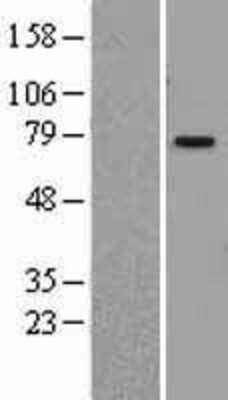 Western Blot: PIAS1 Overexpression Lysate [NBL1-14384]