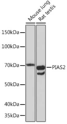 Western Blot: PIAS2 Antibody (4I6K6) [NBP3-16587]