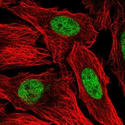 Immunocytochemistry/ Immunofluorescence: PIAS2 Antibody [NBP2-49571]