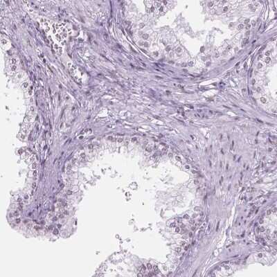 Immunohistochemistry-Paraffin: PIAS2 Antibody [NBP2-49571]