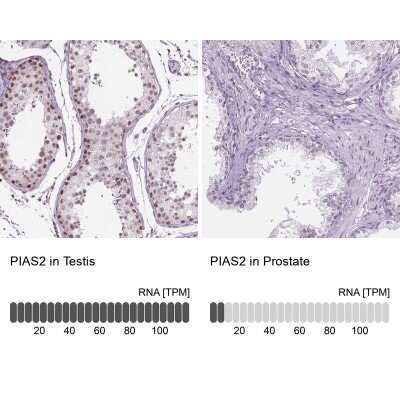 Immunohistochemistry-Paraffin: PIAS2 Antibody [NBP2-49571]