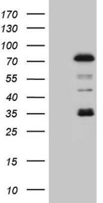 Western Blot: PIAS2 Antibody (OTI2B5)Azide and BSA Free [NBP2-73398]