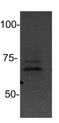 Western Blot: PIAS2 Antibody [NBP1-52022]