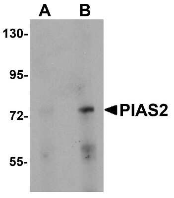 Western Blot: PIAS2 AntibodyBSA Free [NBP1-77159]