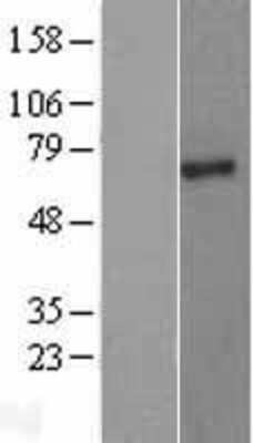 Western Blot: PIAS2 Overexpression Lysate [NBL1-14385]