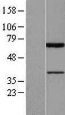 Western Blot: PIAS2 Overexpression Lysate [NBL1-14386]