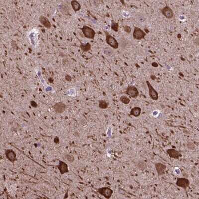 Immunohistochemistry: PIAS3 Antibody [NBP2-48503]