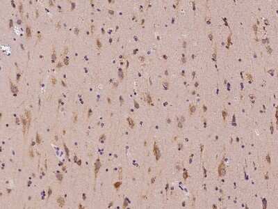 Immunohistochemistry-Paraffin: PIAS3 Antibody [NBP2-98547]