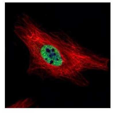 Immunocytochemistry/ Immunofluorescence: PIASy Antibody [NBP1-31215]