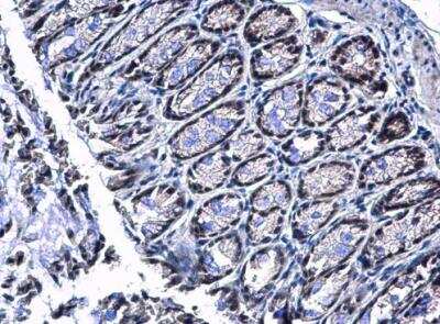 Immunohistochemistry-Paraffin: PIASy Antibody [NBP1-31215]