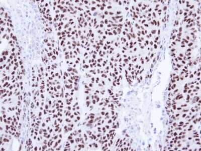 Immunohistochemistry-Paraffin: PIASy Antibody [NBP1-31215]