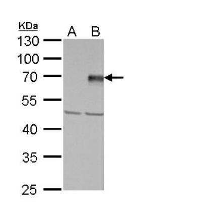 Western Blot: PIASy Antibody [NBP1-31215]