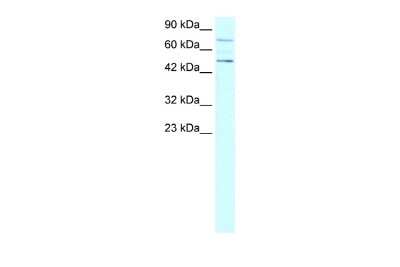 Western Blot: PIASy Antibody [NBP2-82306]