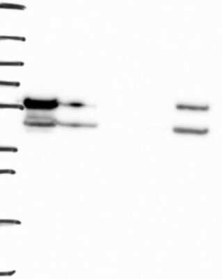 Western Blot: PIASy Antibody [NBP3-17791]