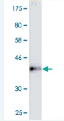 Western Blot: PIBF1 Antibody (7A3) [H00010464-M01]