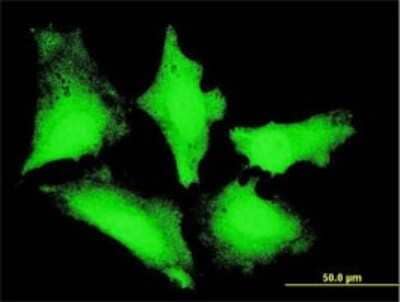 Immunocytochemistry/ Immunofluorescence: PIBF1 Antibody (7B7) [H00010464-M02]