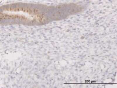 Immunohistochemistry-Paraffin: PIBF1 Antibody (7B7) [H00010464-M02]