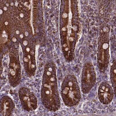 Immunohistochemistry: PIBF1 Antibody [NBP2-49474]