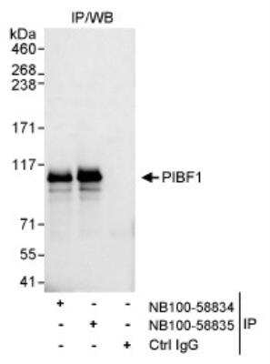 Western Blot: PIBF1 Antibody [NB100-58834]