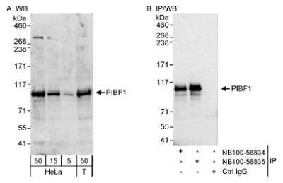 Western Blot: PIBF1 Antibody [NB100-58835]