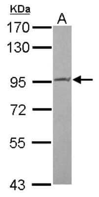 Western Blot: PIBF1 Antibody [NBP2-19823]