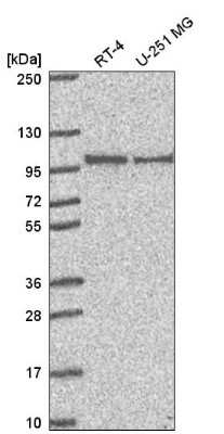 Western Blot: PIBF1 Antibody [NBP2-56805]