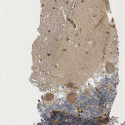 Immunohistochemistry-Paraffin: PICALM Antibody [NBP1-86658]