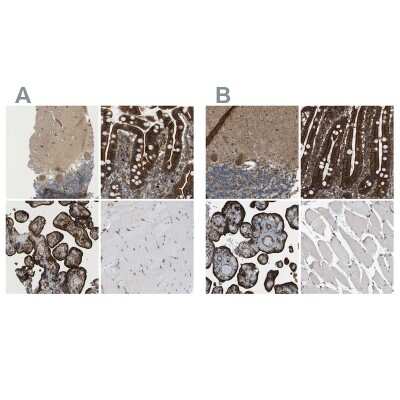 Immunohistochemistry-Paraffin: PICALM Antibody [NBP1-86658]