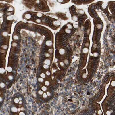 Immunohistochemistry-Paraffin: PICALM Antibody [NBP1-86658]