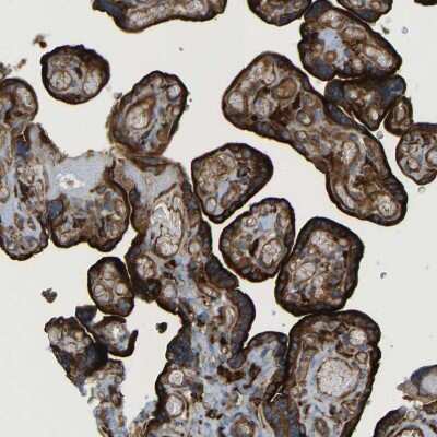 Immunohistochemistry-Paraffin: PICALM Antibody [NBP1-86658]