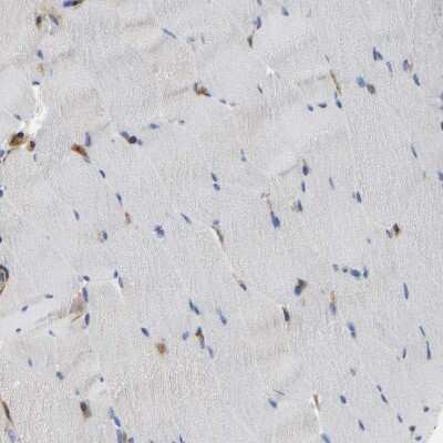 Immunohistochemistry-Paraffin: PICALM Antibody [NBP1-86658]