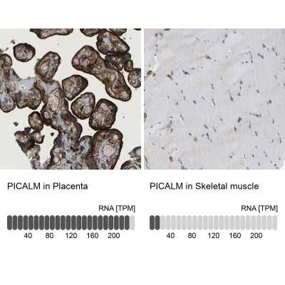 Immunohistochemistry-Paraffin: PICALM Antibody [NBP1-86658]