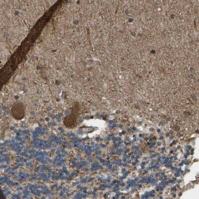 Immunohistochemistry-Paraffin: PICALM Antibody [NBP1-86659]