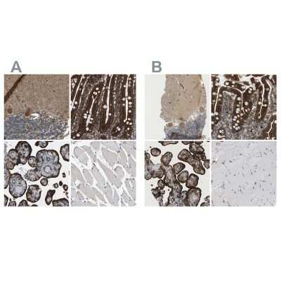 Immunohistochemistry-Paraffin: PICALM Antibody [NBP1-86659]