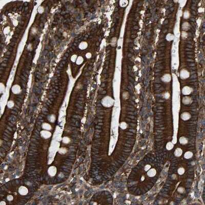 Immunohistochemistry-Paraffin: PICALM Antibody [NBP1-86659]