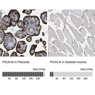 Immunohistochemistry-Paraffin: PICALM Antibody [NBP1-86659]