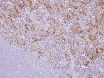 Immunohistochemistry-Paraffin: PICALM Antibody [NBP2-19825]
