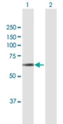 Western Blot: PICALM Antibody [H00008301-B01P]