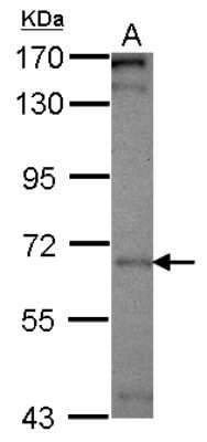 Western Blot: PICALM Antibody [NBP2-19824]