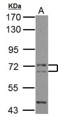 Western Blot: PICALM Antibody [NBP2-19824]