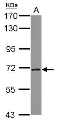 Western Blot: PICALM Antibody [NBP2-19825]