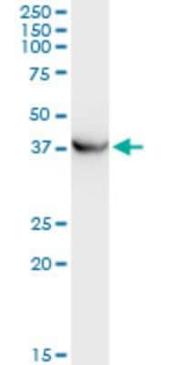 Western Blot: PICK1 Antibody (3G5) [H00009463-M01]