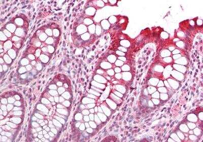Immunohistochemistry-Paraffin: PICK1 Antibody [NB100-41403]